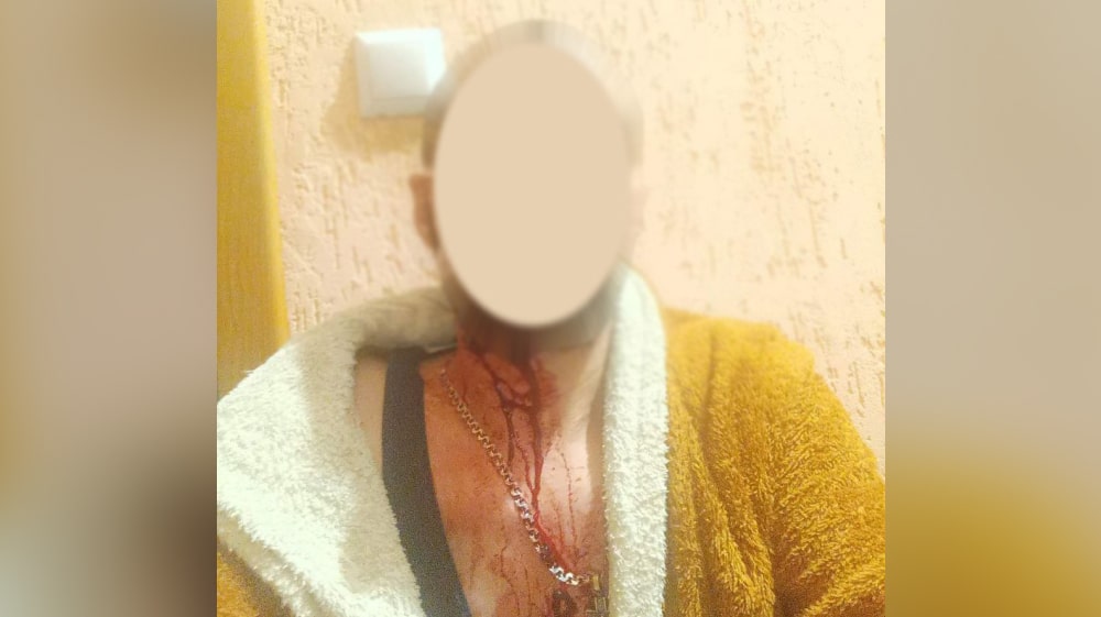 Сусідський конфлікт у Ладижині закінчився ножовим пораненням